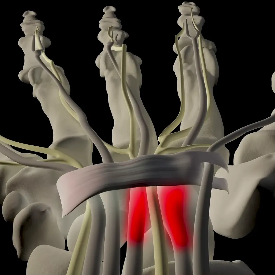 2. His Joint Pain Subsided, Gradually